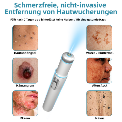 𝐉𝐚𝐬𝐬𝐞𝐞𝐦® 🌳Nicht-invasive Laserstift zur Entfernung von Hautflecken und Warzen (Schnelle und schmerzlose Entfernung von Warzen, Muttermalen, Altersflecken und Hautunreinheiten – ganz ohne Nebenwirkungen) 🔥