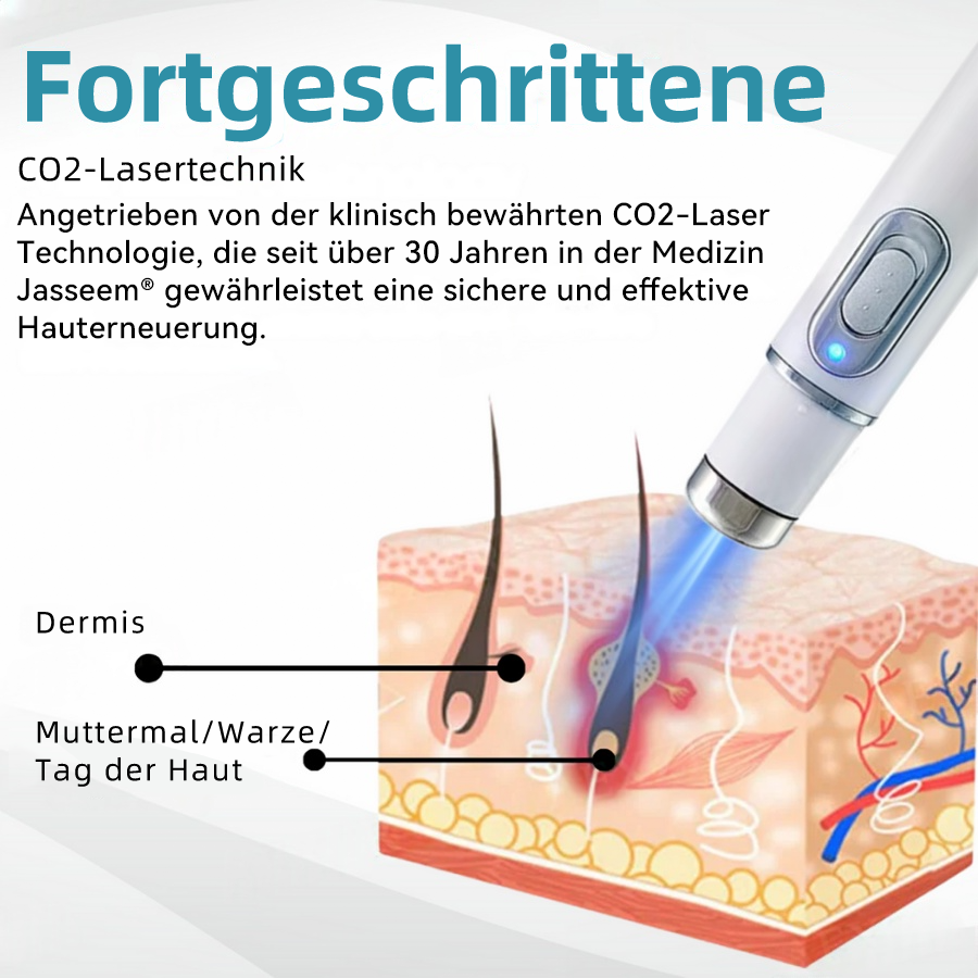 𝐉𝐚𝐬𝐬𝐞𝐞𝐦® 🌳Nicht-invasive Laserstift zur Entfernung von Hautflecken und Warzen (Schnelle und schmerzlose Entfernung von Warzen, Muttermalen, Altersflecken und Hautunreinheiten – ganz ohne Nebenwirkungen) 🔥